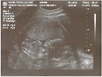 Garysbaby3.jpg